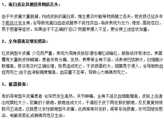 莫要忽視牛皮癬疾病，以下幾種危害你了解嗎？