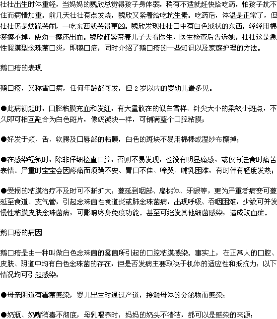 鵝口瘡