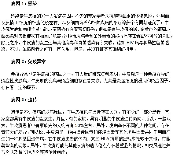 最常見的牛皮癬發(fā)病病因有什么？