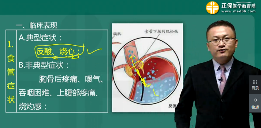 胃食管反流?。℅ERD）的藥物治療方法-消化系統(tǒng)高頻考點(diǎn)