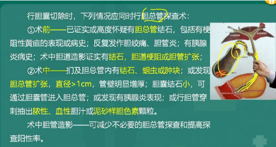 膽囊管內(nèi)多發(fā)泥沙樣結石
