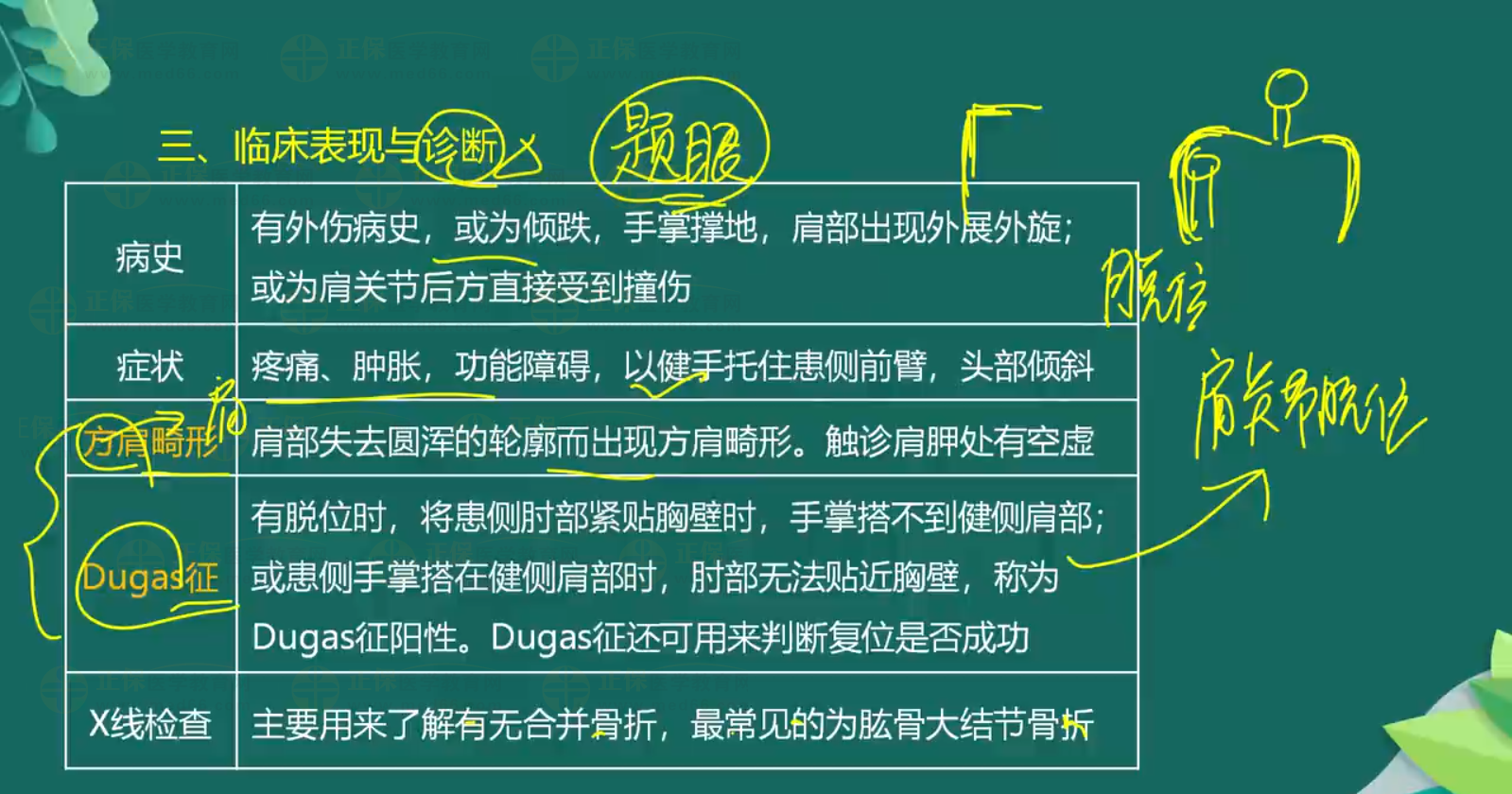 關(guān)節(jié)脫位-顳下頜關(guān)節(jié)脫位、肩關(guān)節(jié)脫位知識點總結(jié)-3